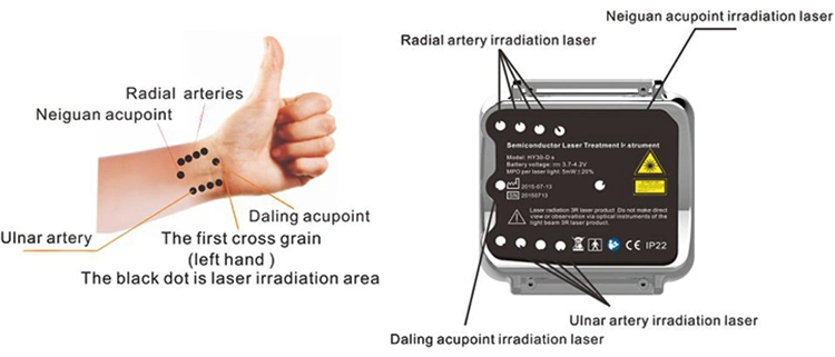 Laser Therapy Instrument for Cardiovascular and Cerebrovascular Diseases